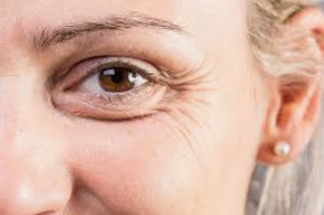 10 ways to reduce wrinkles under the eyes!